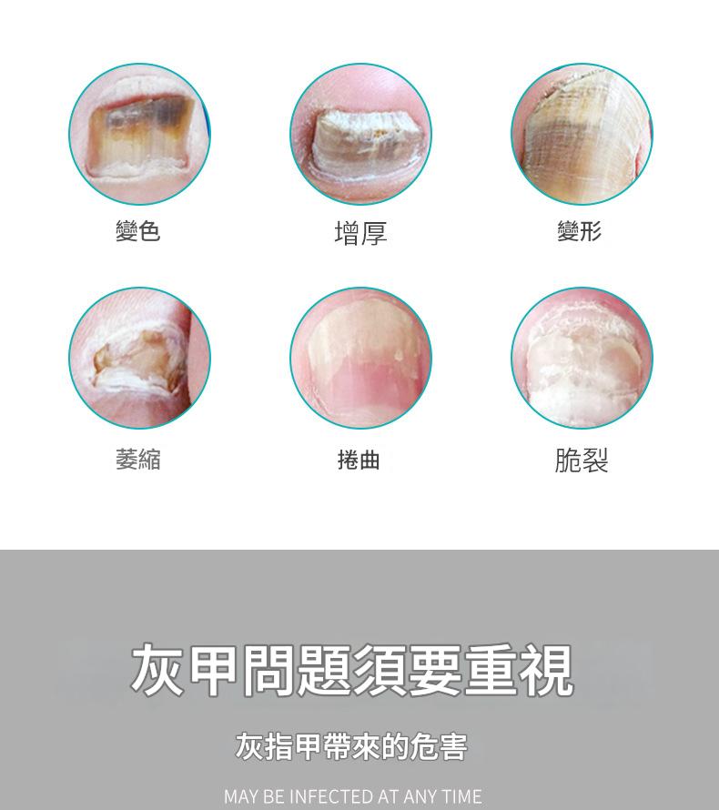 ( 日本 )東田製藥鳳仙草配方特效灰指甲護理液30ml/盒