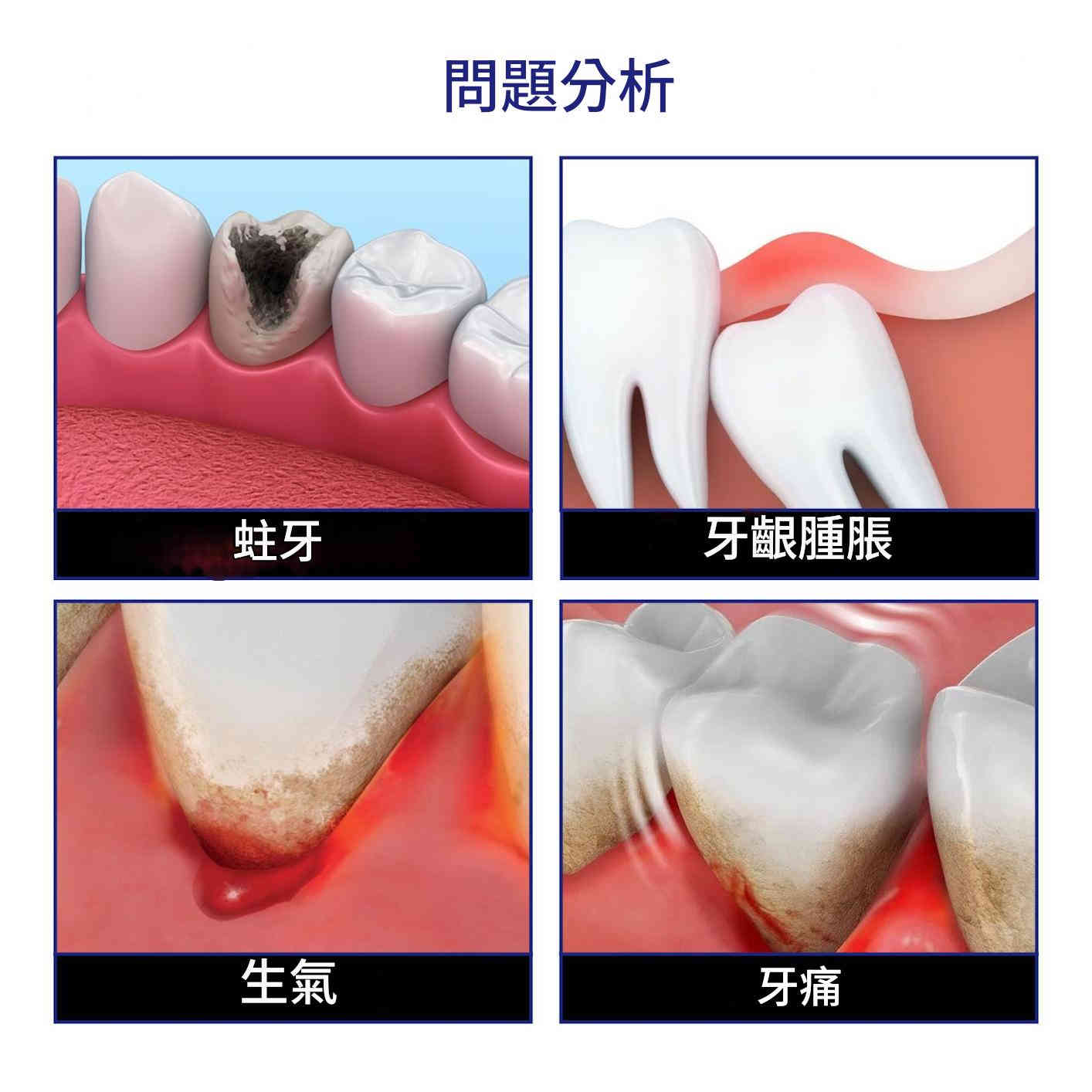 soufn moen 金銀花綠果冰片天然提取物特效牙痛噴霧 20ml/盒