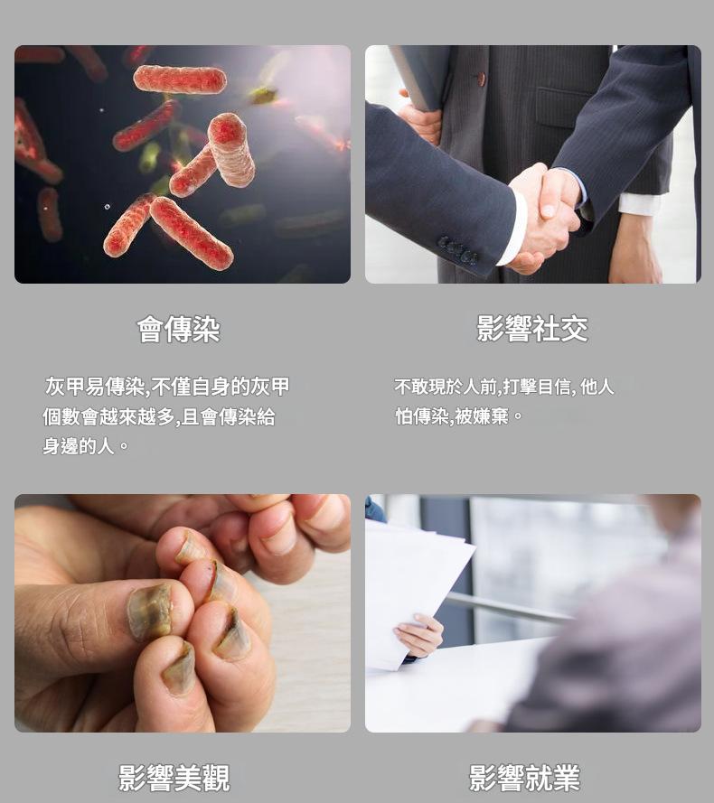 ( 日本 )東田製藥鳳仙草配方特效灰指甲護理液30ml/盒