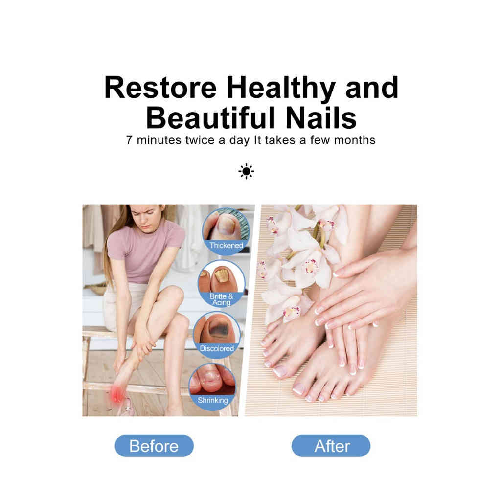 紫外線灰甲光療燈