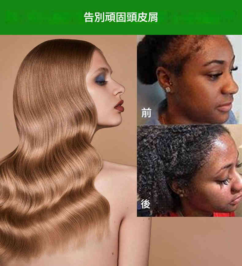 oyat 巴塔納油促進頭髮生長保濕護髮特效液 30ml/盒