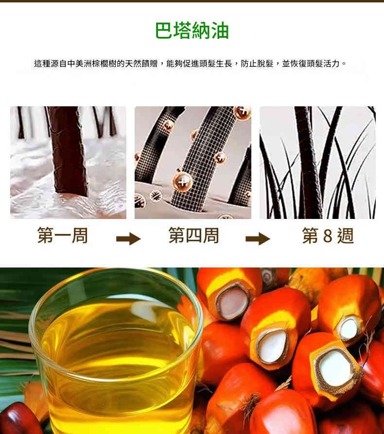 oyat 巴塔納油促進頭髮生長保濕護髮特效液 30ml/盒