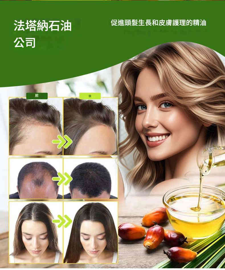 oyat 巴塔納油促進頭髮生長保濕護髮特效液 30ml/盒