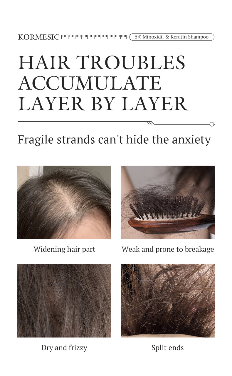 KORMESIC 5%米諾地爾角蛋白生髮護理套裝 CUN00102 18