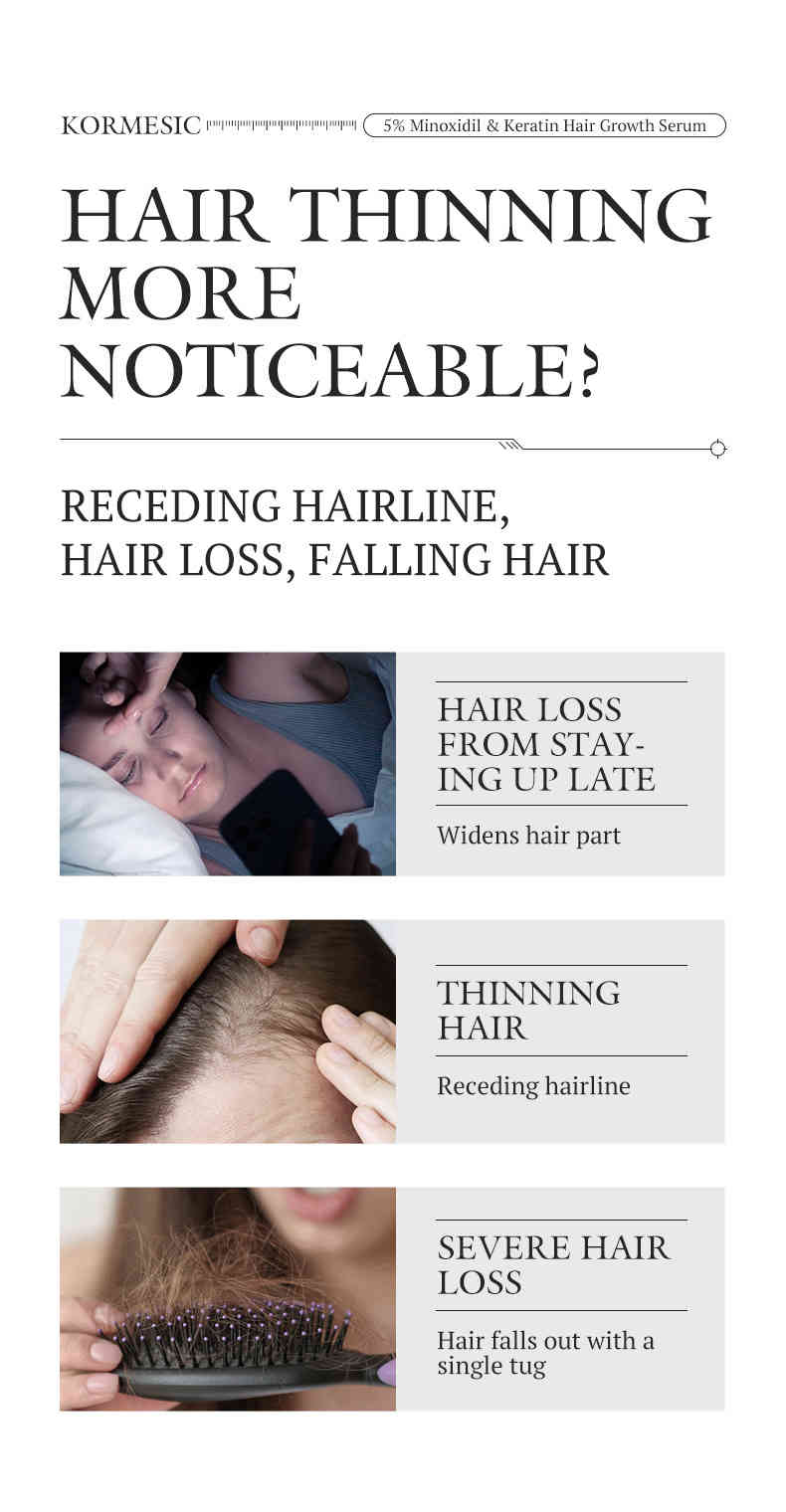 KORMESIC 5%米諾地爾角蛋白生髮護理套裝 CUN00102 2