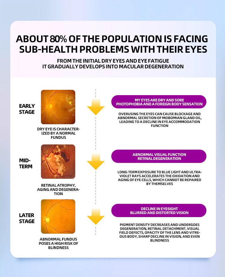becoiyan 紫色升級款 葉黃素潤目護眼液 10ml