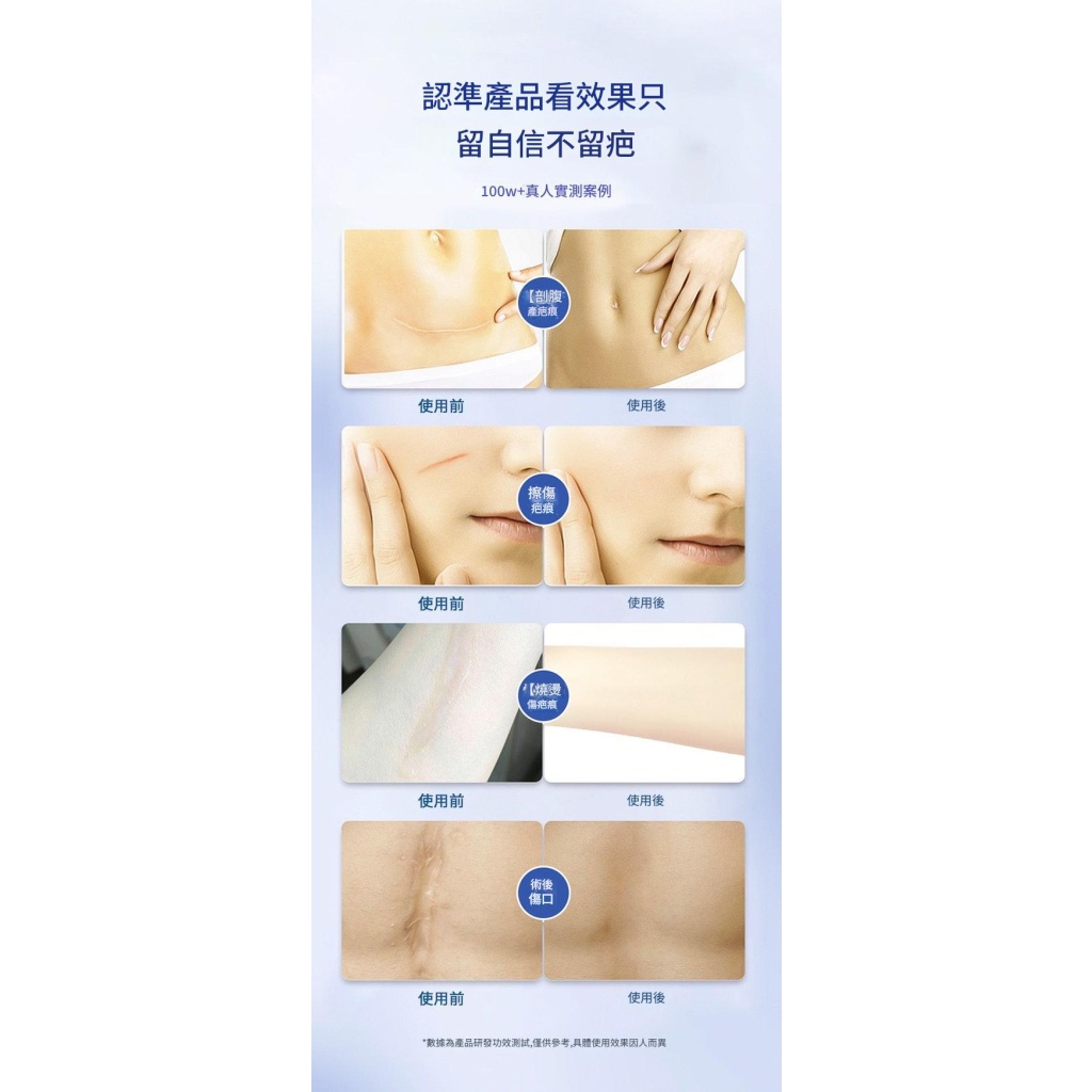 kinbt疤痕膏亮膚身體傷疤痘痕疤祛疤膏淡化痘坑印2盒裝