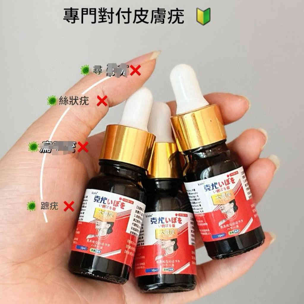 kinbt克疣液扁平尤小肉粒頸肉粒疣立淨克草本清疣護理液2支裝