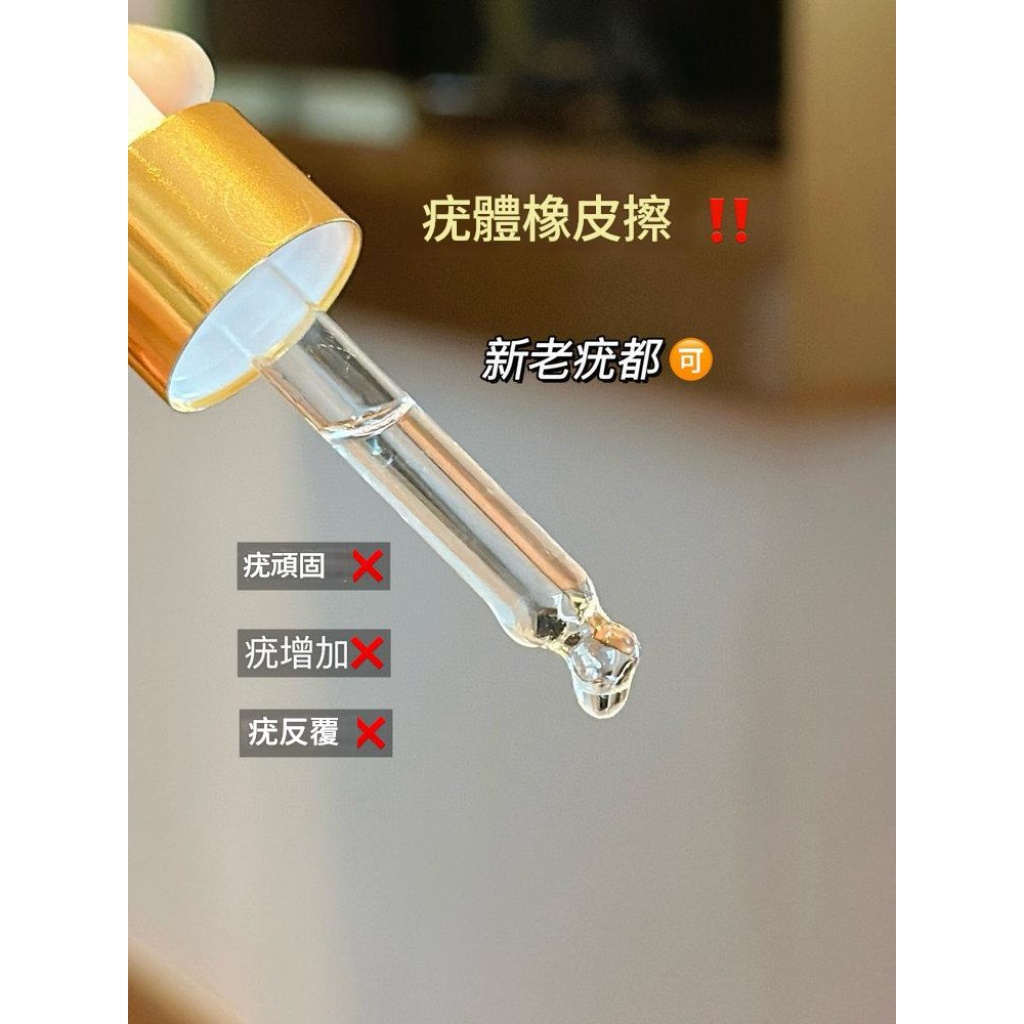 kinbt克疣液扁平尤小肉粒頸肉粒疣立淨克草本清疣護理液2支裝