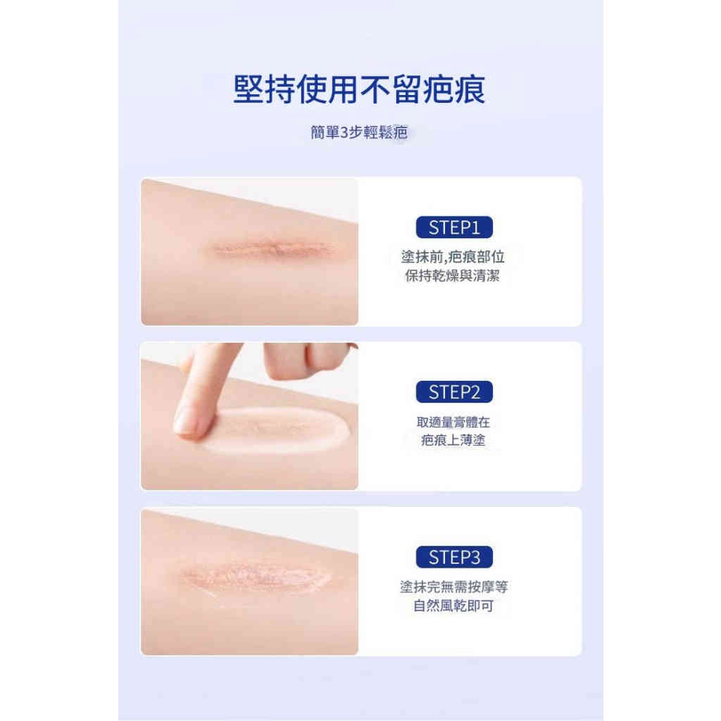 kinbt疤痕膏亮膚身體傷疤痘痕疤祛疤膏淡化痘坑印2盒裝