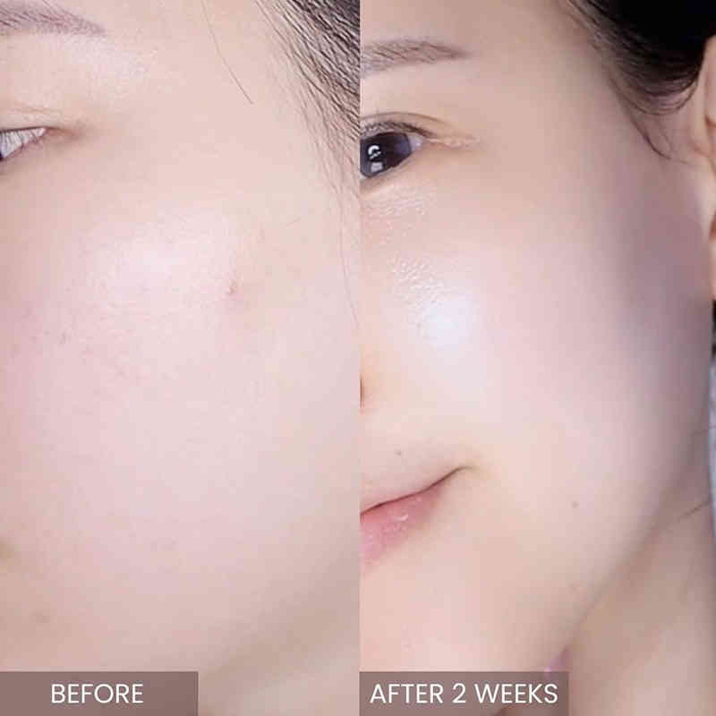 粉紅茶樹強效修護面霜 50g/盒