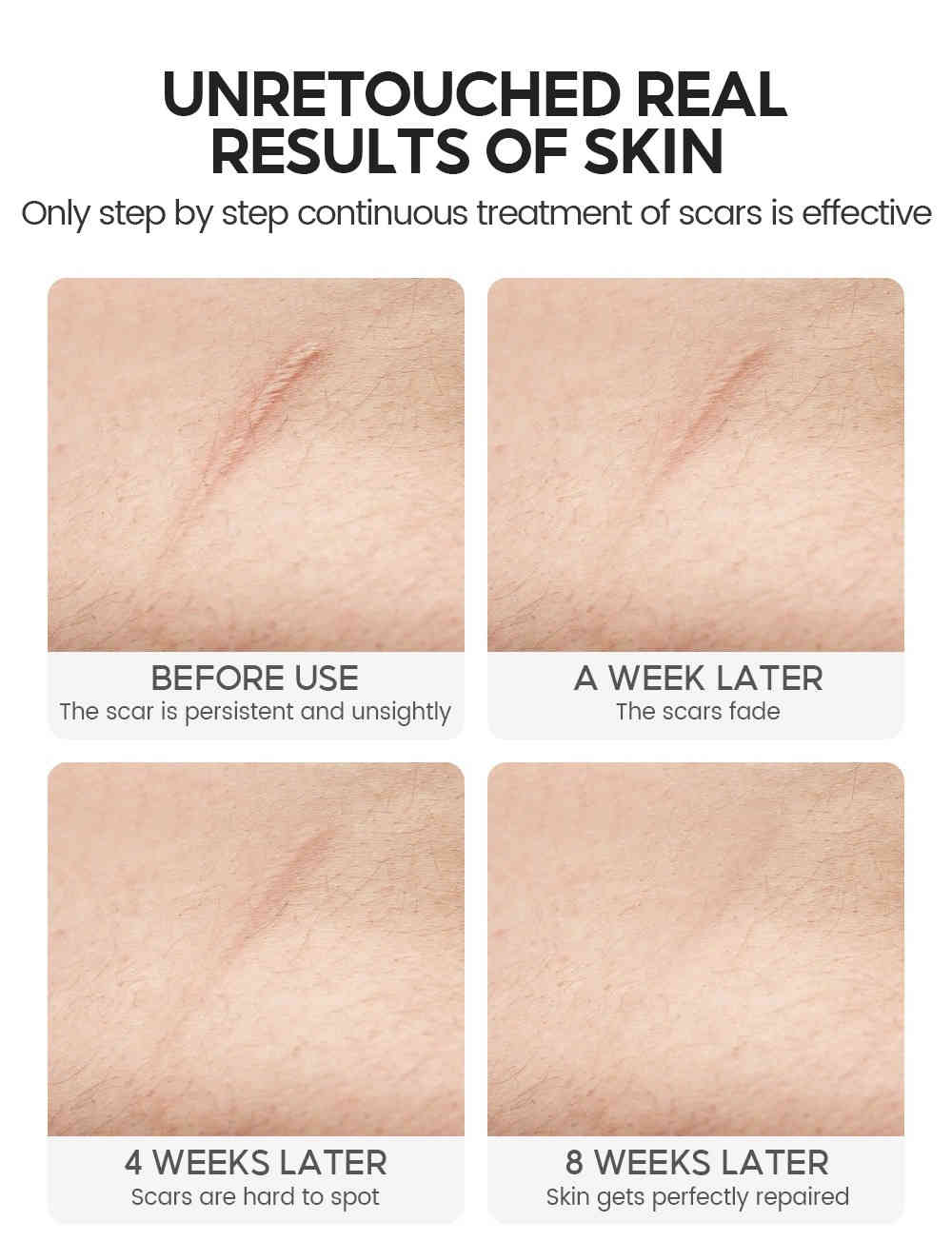 vibrant glamour® 第二代鱷魚油修護淡疤面霜 30g/盒