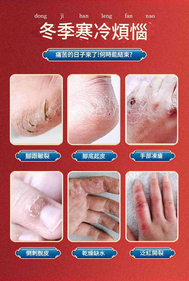 [日本] 倉井奧科紅花蛇油凍康膏 30g/盒