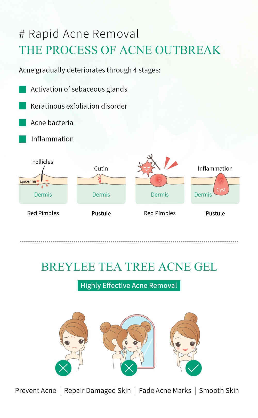 breylee 茶樹精油抗痘修復凝膠 15g/盒