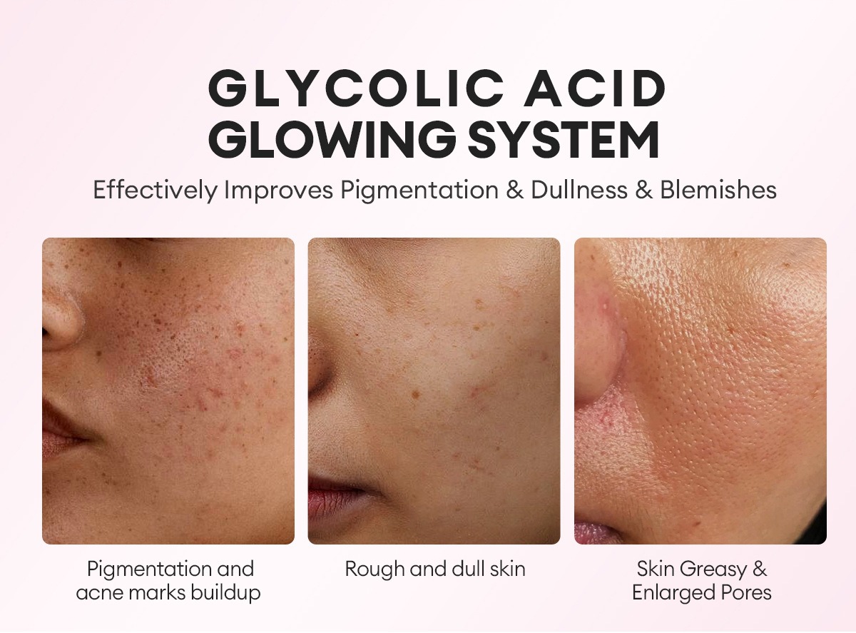 vibrant glamour 甘醇酸煥膚亮白爽膚水 100ml/盒