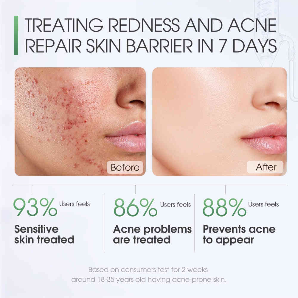 skinever 積雪草舒緩修護面膜 20ml/盒