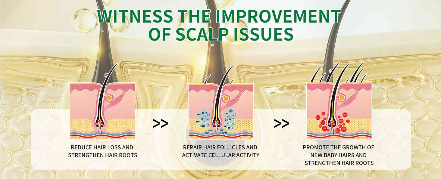 w3w 滾珠式植物養髮精華液 30ml/盒