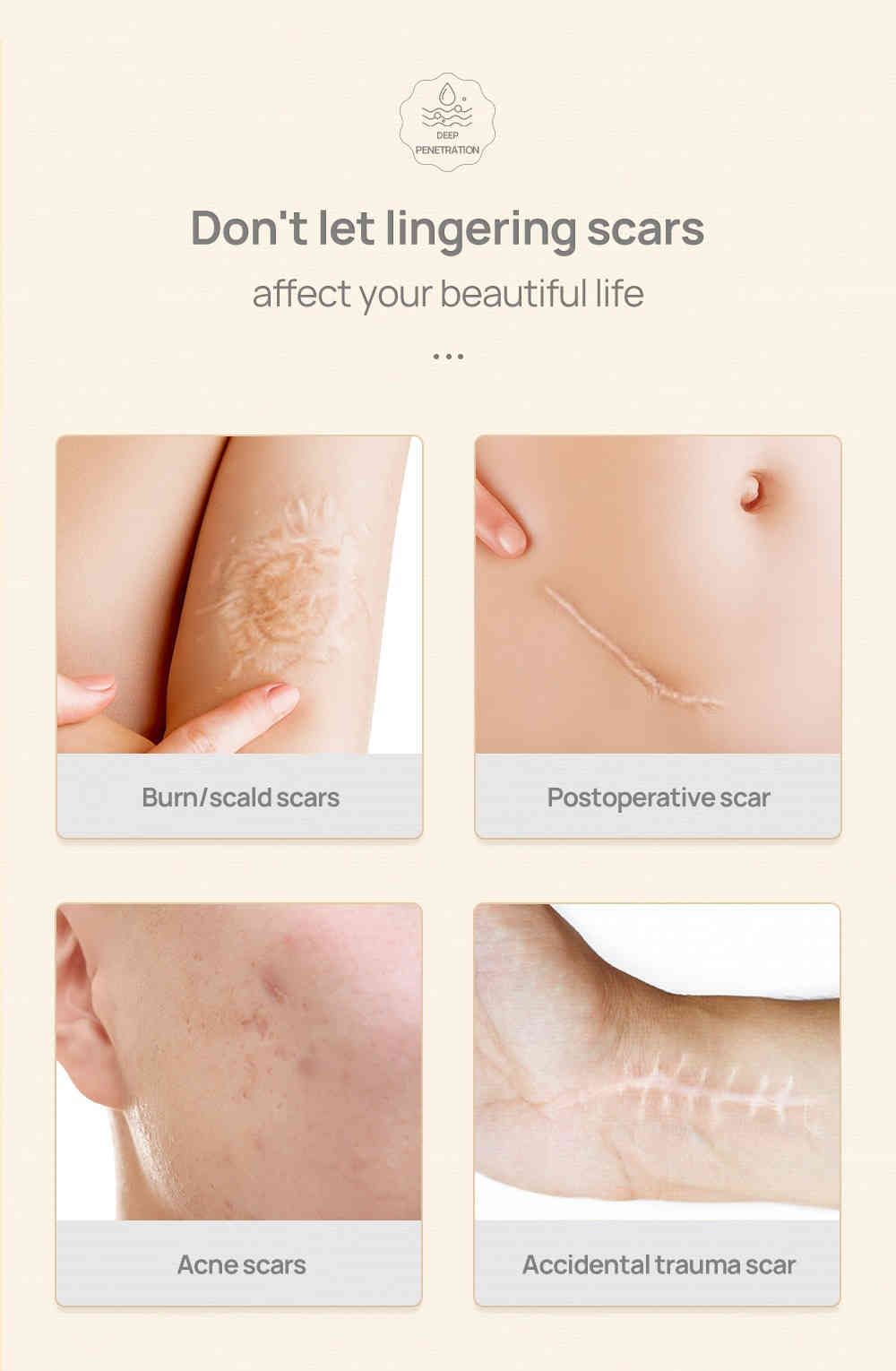 lanbena 草本修護淡疤精華 20ml/盒