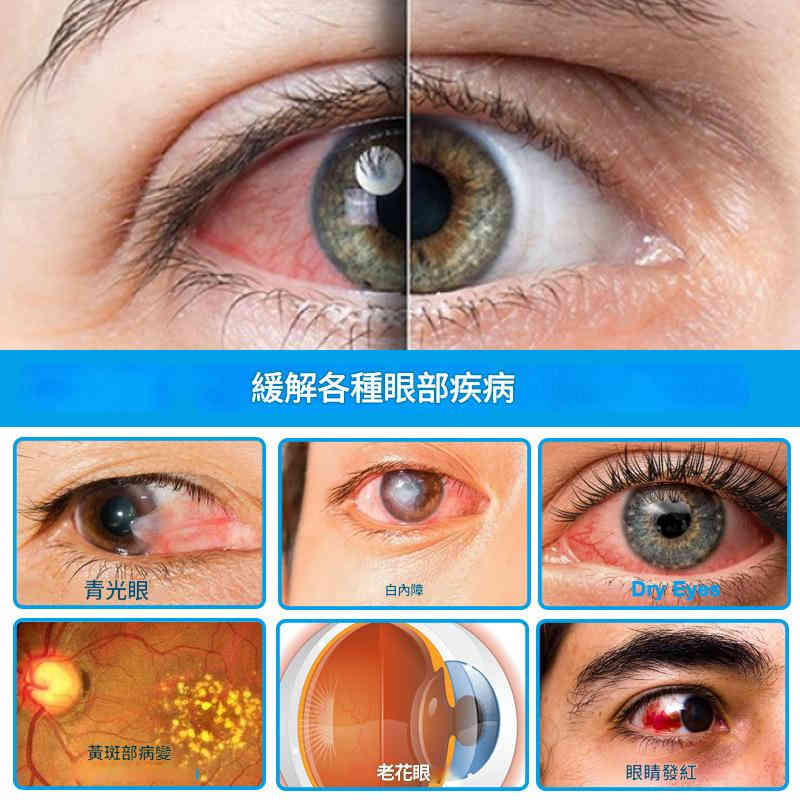 hbesty 舒緩眼藥水 15ml/盒