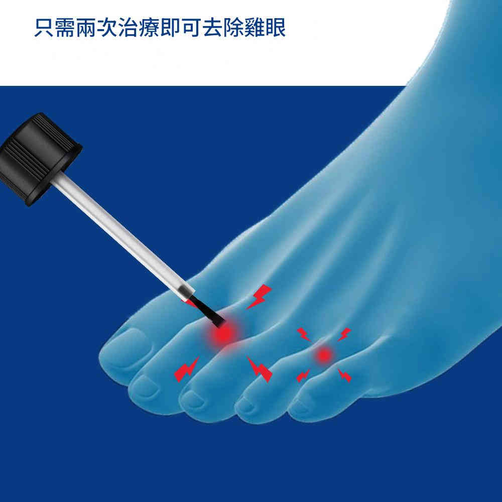 hbesty 雞眼疣去除液 30ml/盒