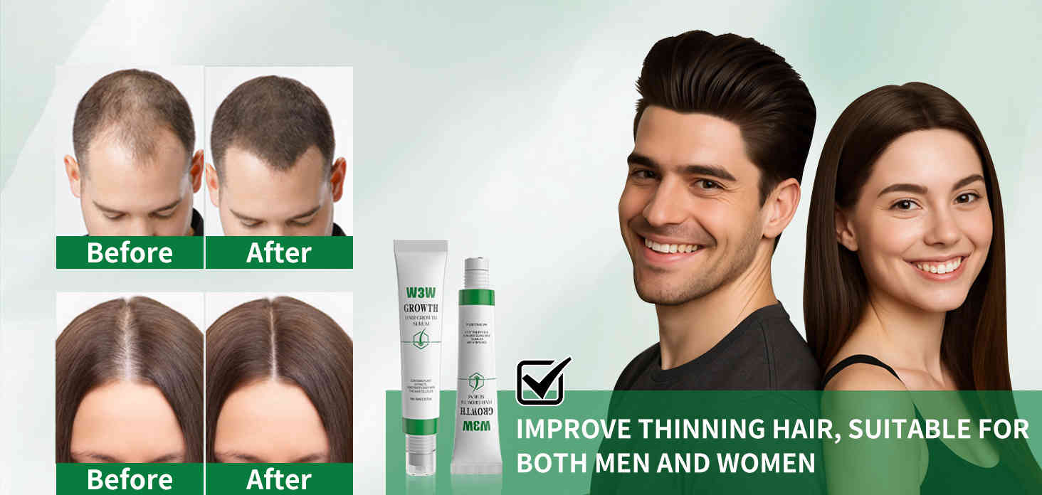 w3w 滾珠式植物養髮精華液 30ml/盒