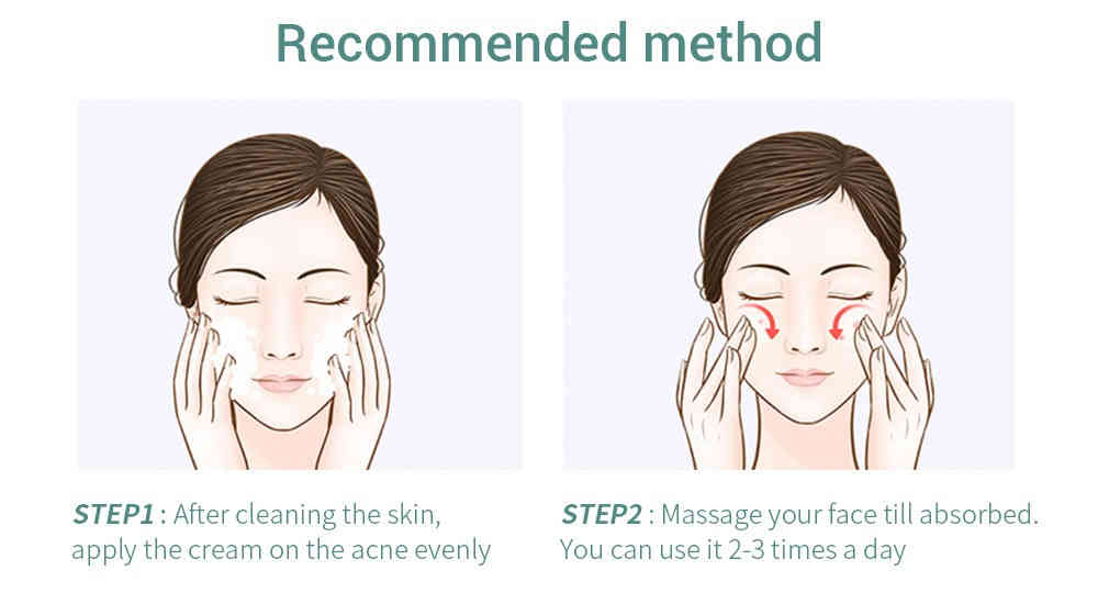 lanbena 草本抗痘調理凝膠 20g/盒