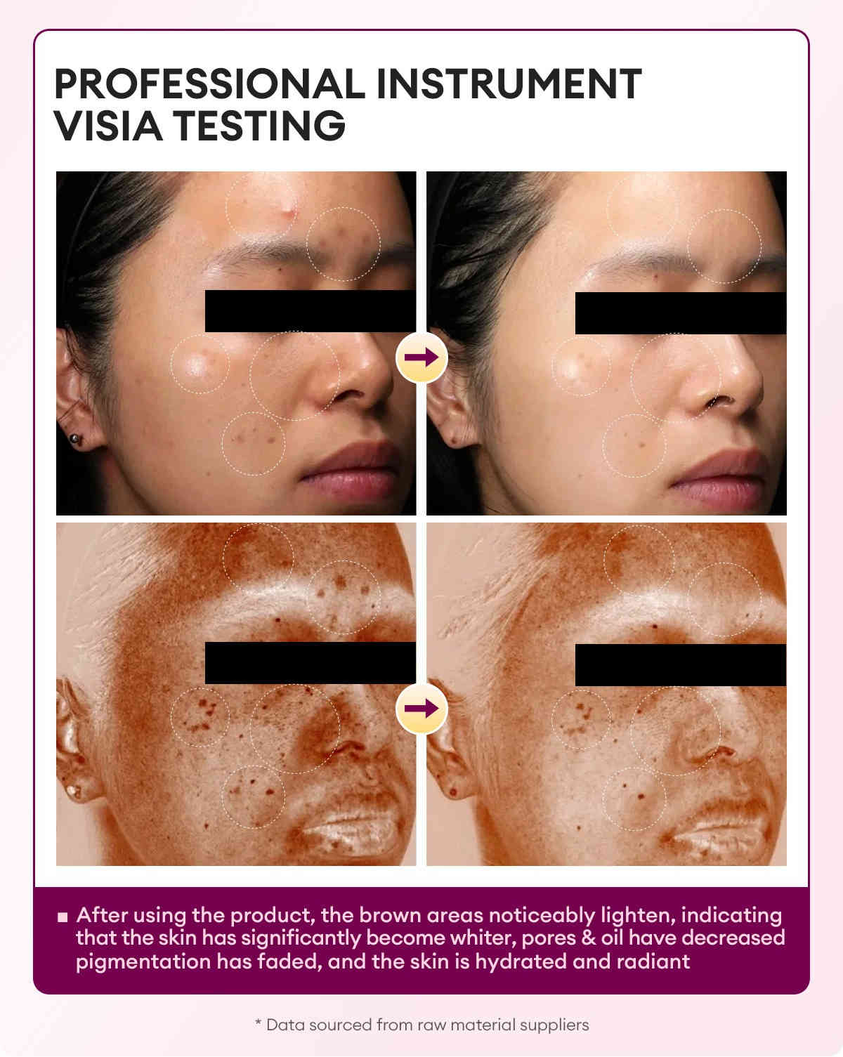 vibrant glamour 甘醇酸煥膚亮白爽膚水 100ml/盒