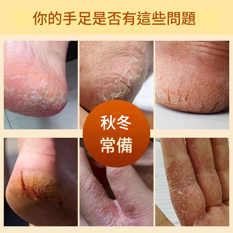 [日本] 東岐製藥植物配方鈍裂膏 50g/盒