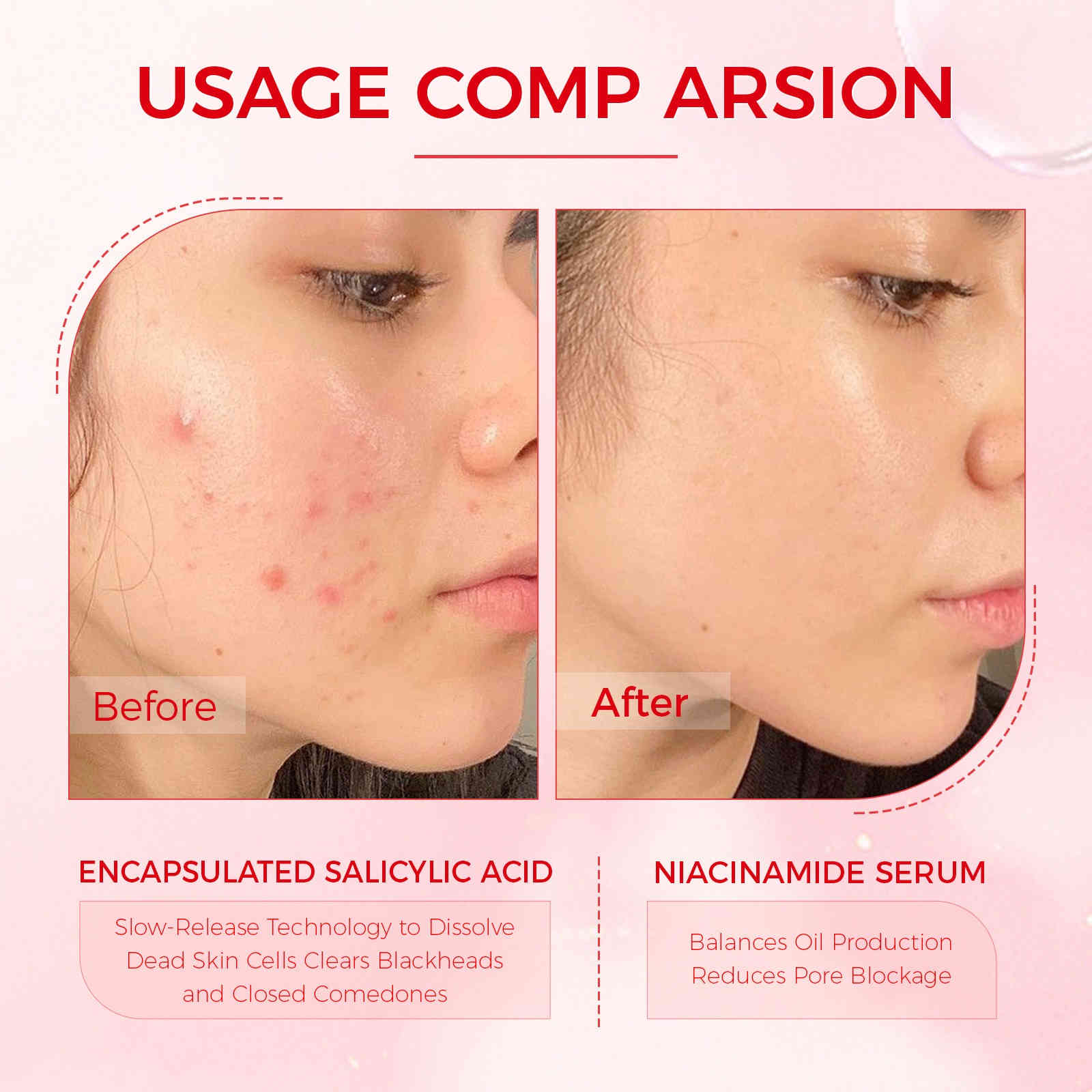 oukeya 2%水楊酸＋5%菸鹼醯胺戰痘小粉水 10ml/盒x3