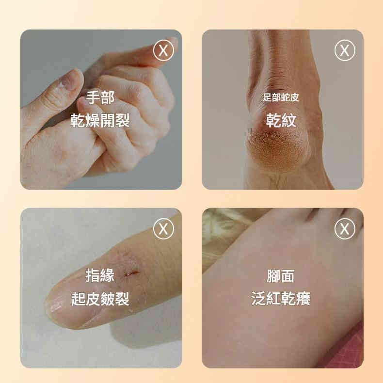 [日本] 東岐製藥植物配方鈍裂膏 50g/盒