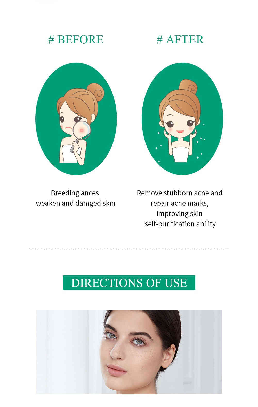 breylee 茶樹精油抗痘修護筆 3ml/盒