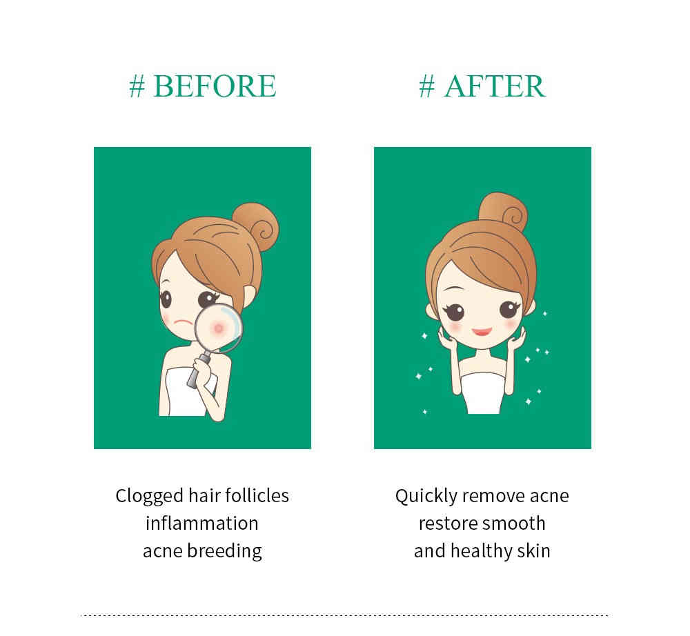 breylee 茶樹精油抗痘修復凝膠 15g/盒