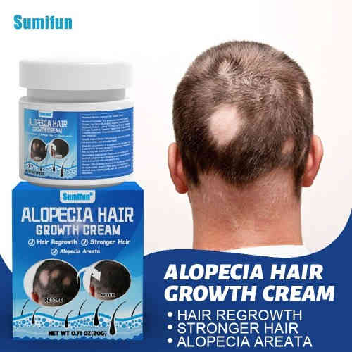 sumifun 斑禿膏 20/g盒