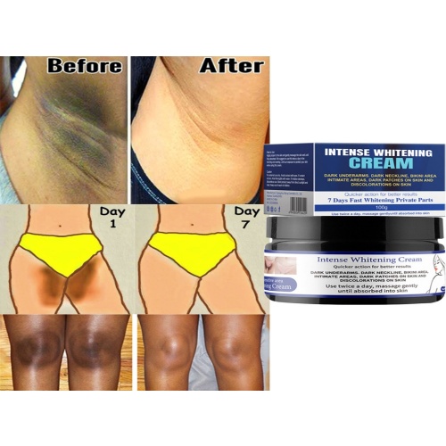 mooyam 雪潤私密嫩白霜 30g