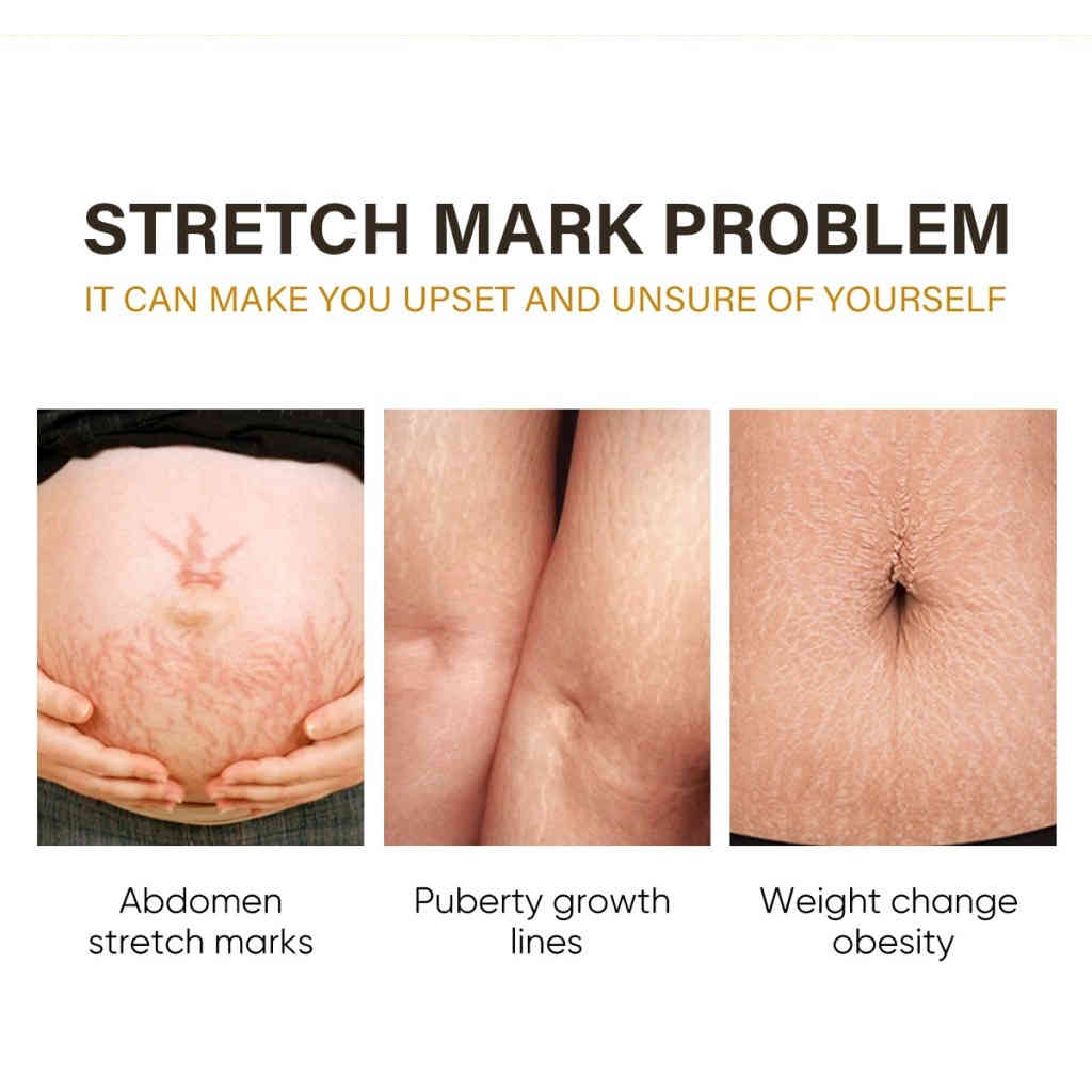 植萃淡紋緊緻護理油 100g