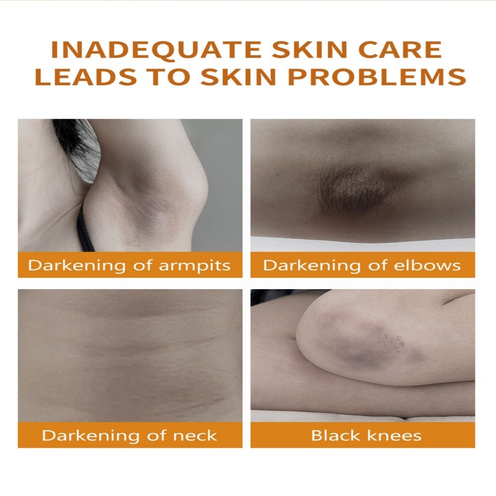 mooyam 私密處淨斑修護乳 60ml x2