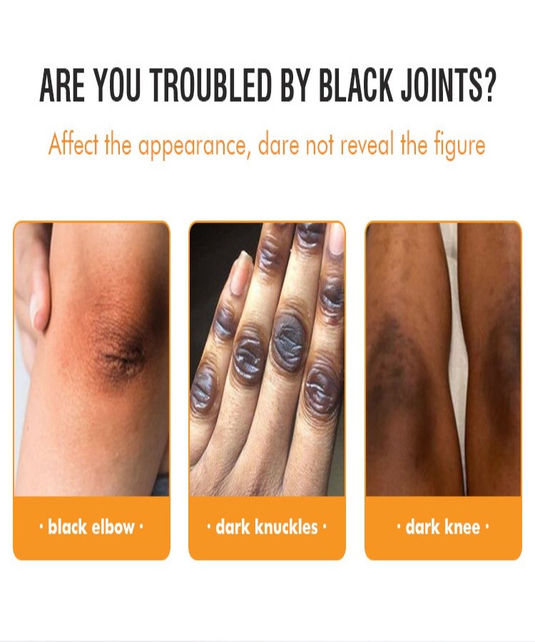 mooyam 關節煥白按摩霜 120（g/ml）