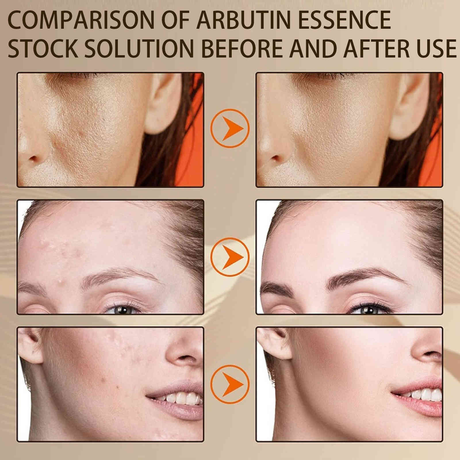 yuriersu α 熊果素2% + 玻尿酸原液 30ml/瓶x2