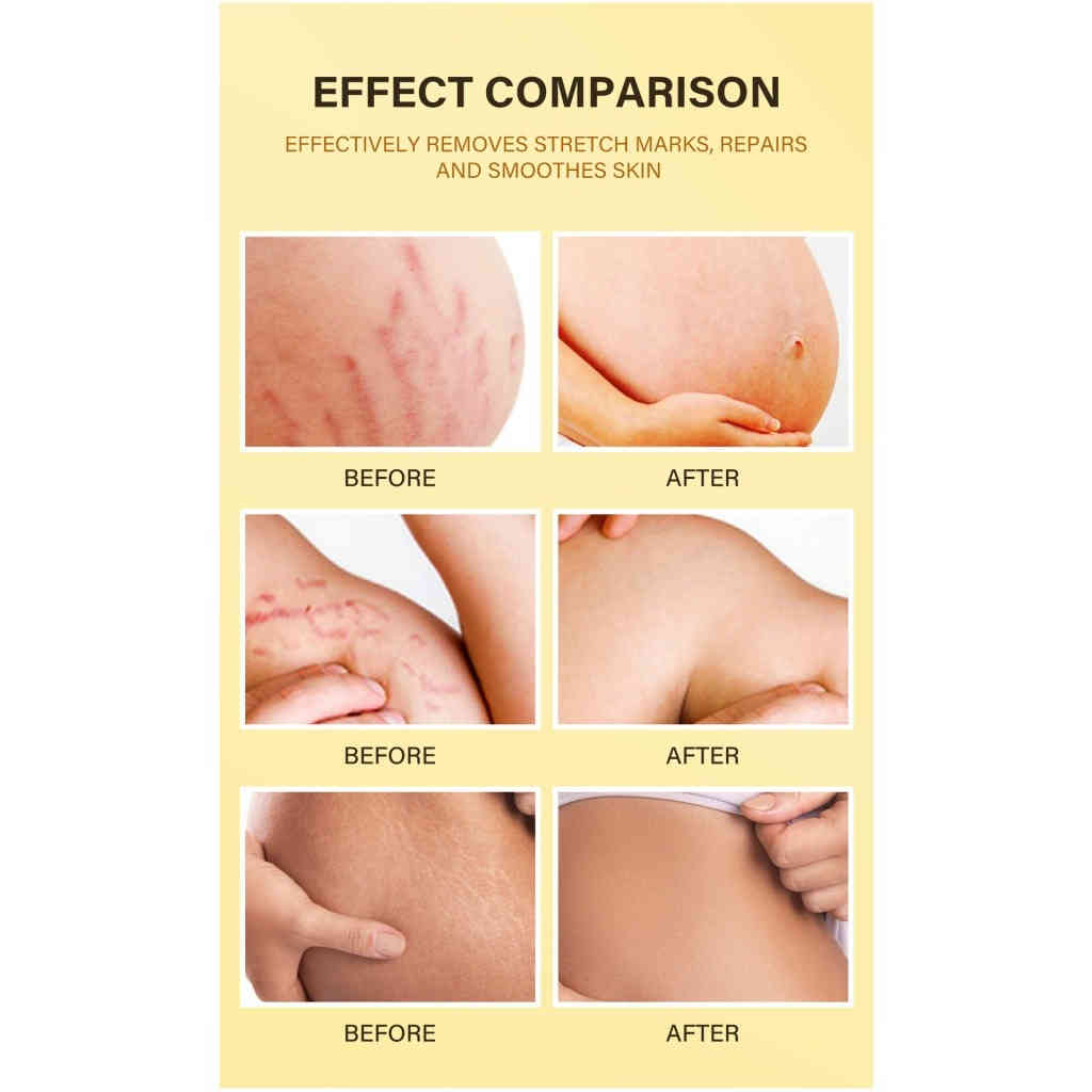 植萃淡紋緊緻護理油 100g