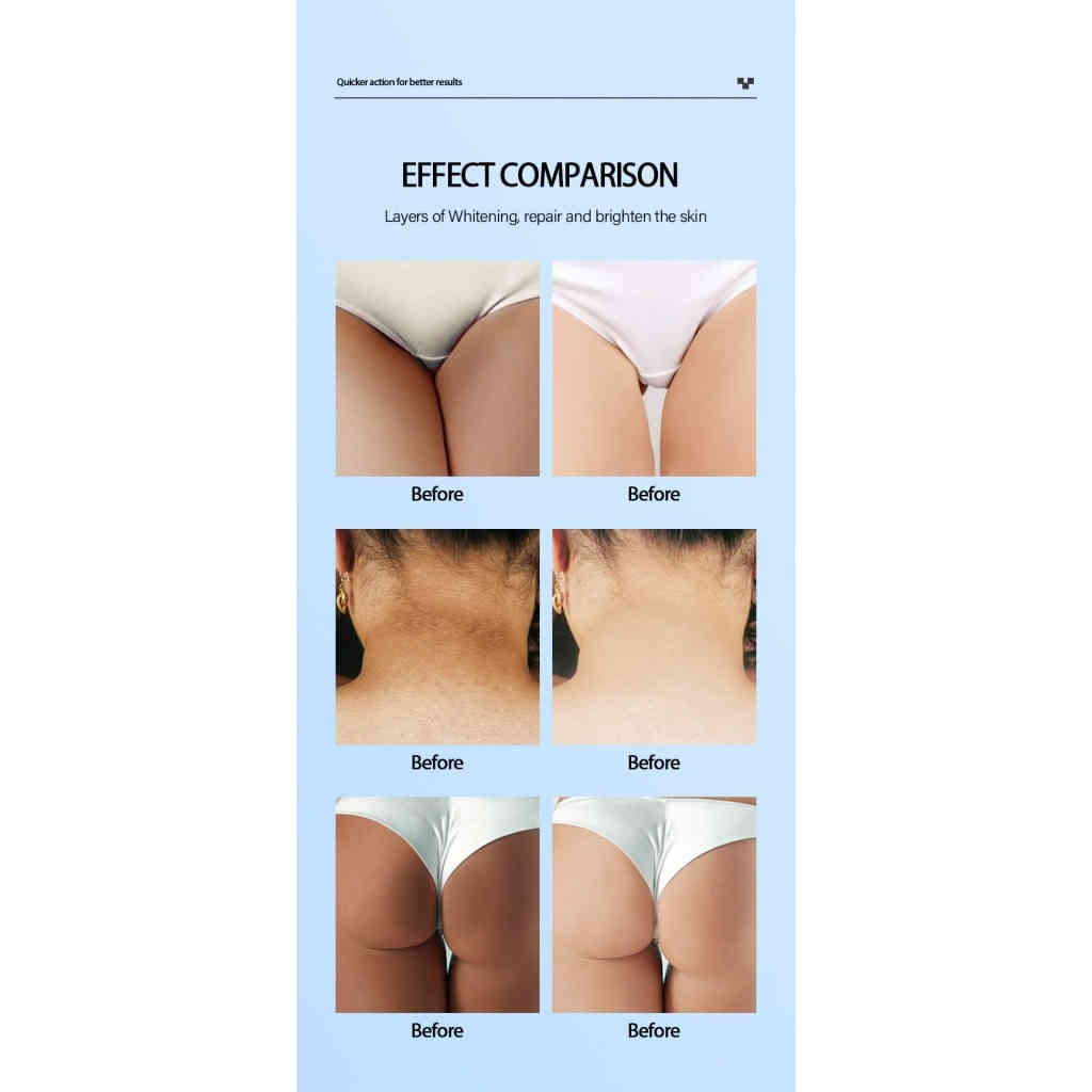 mooyam 雪潤私密嫩白霜 30g