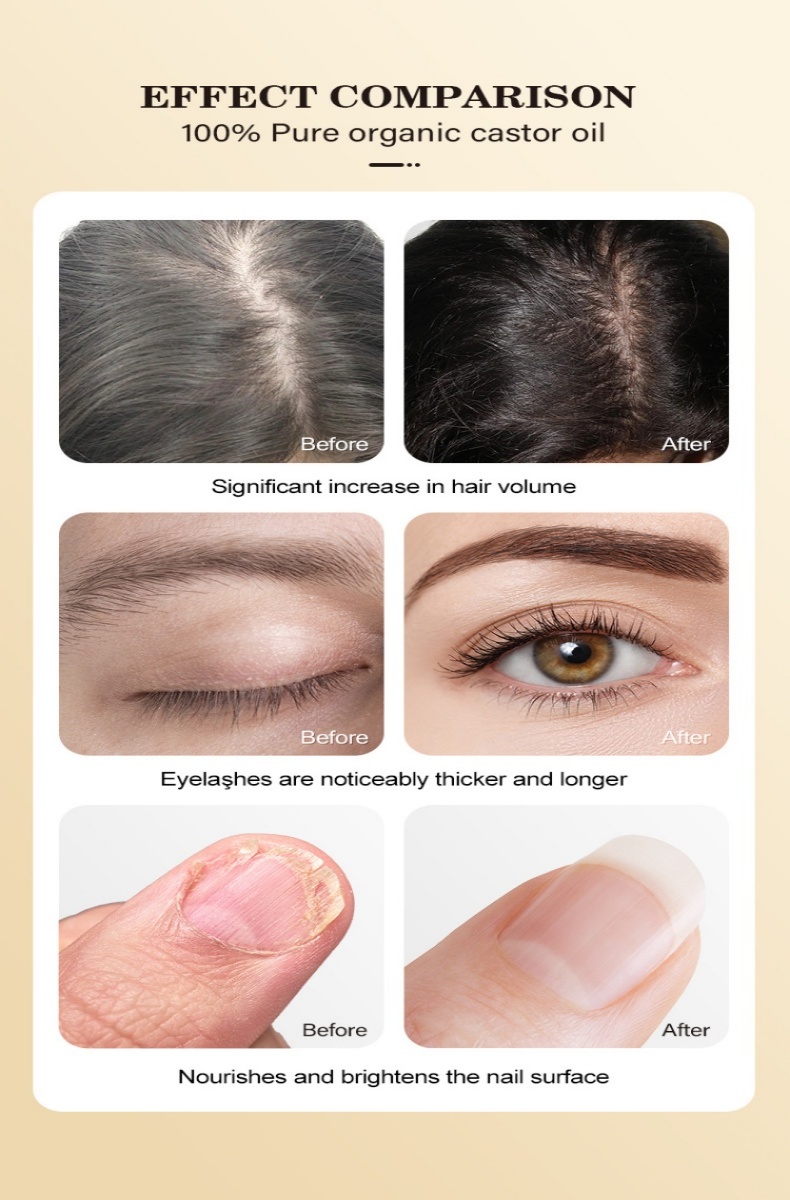 mooyam 護膚護髮全能助手 有機蓖麻油