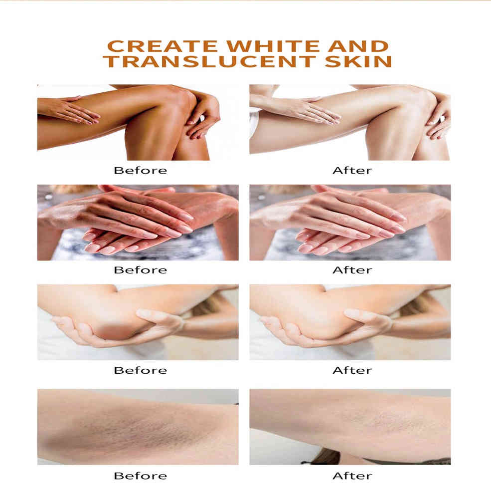 mooyam 私密處淨斑修護乳 60ml x2