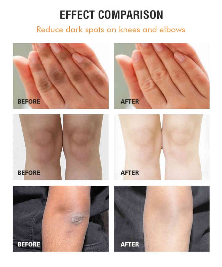 mooyam 關節煥白按摩霜 120（g/ml）