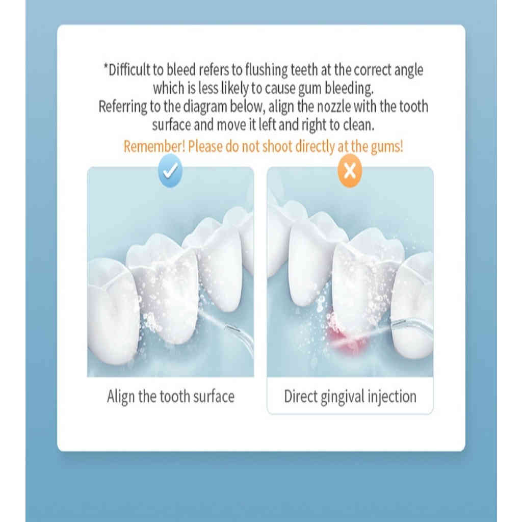 專業脈衝式電動沖牙機（多段水壓／去牙結石／牙齦護理）