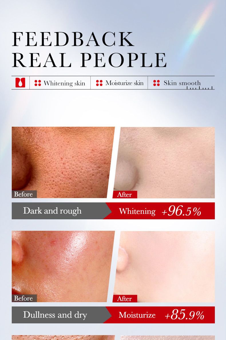 sadoer曲酸美白祛斑六件套