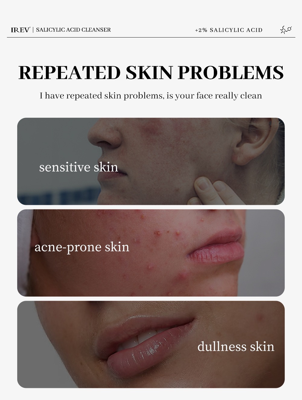 2%水楊酸水楊酸潔面乳100ml/支