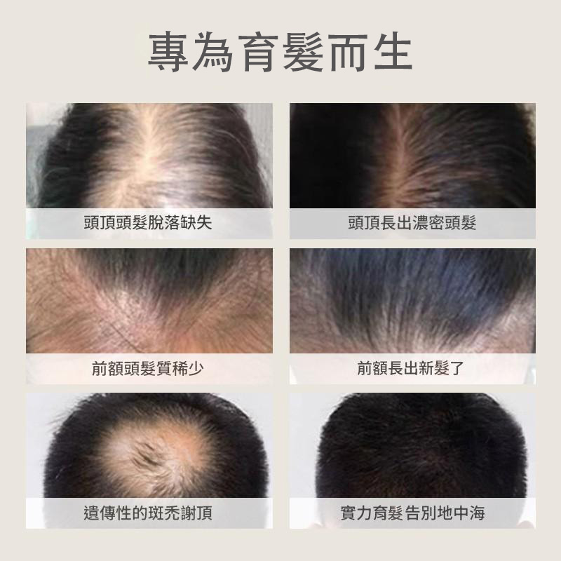 進口植物草本特妝防脫育發液