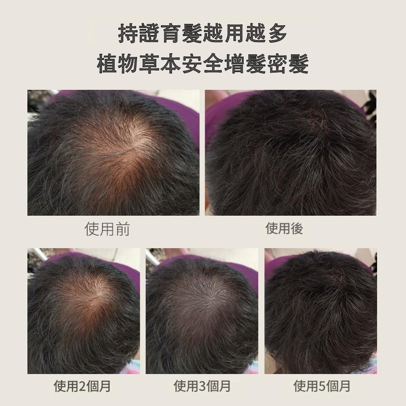 進口植物草本特妝防脫育發液