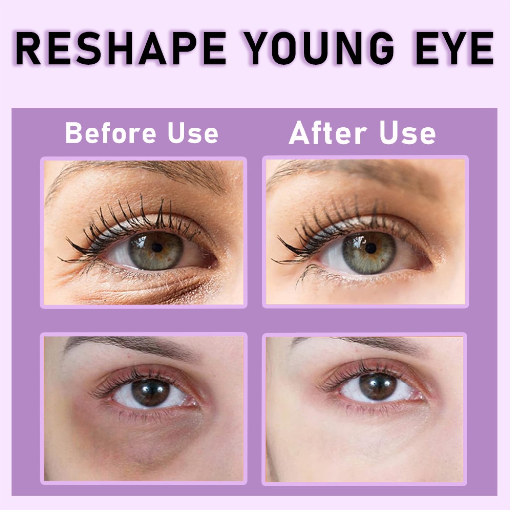 koec retinol 緊緻抗皺眼霜 20ml/盒