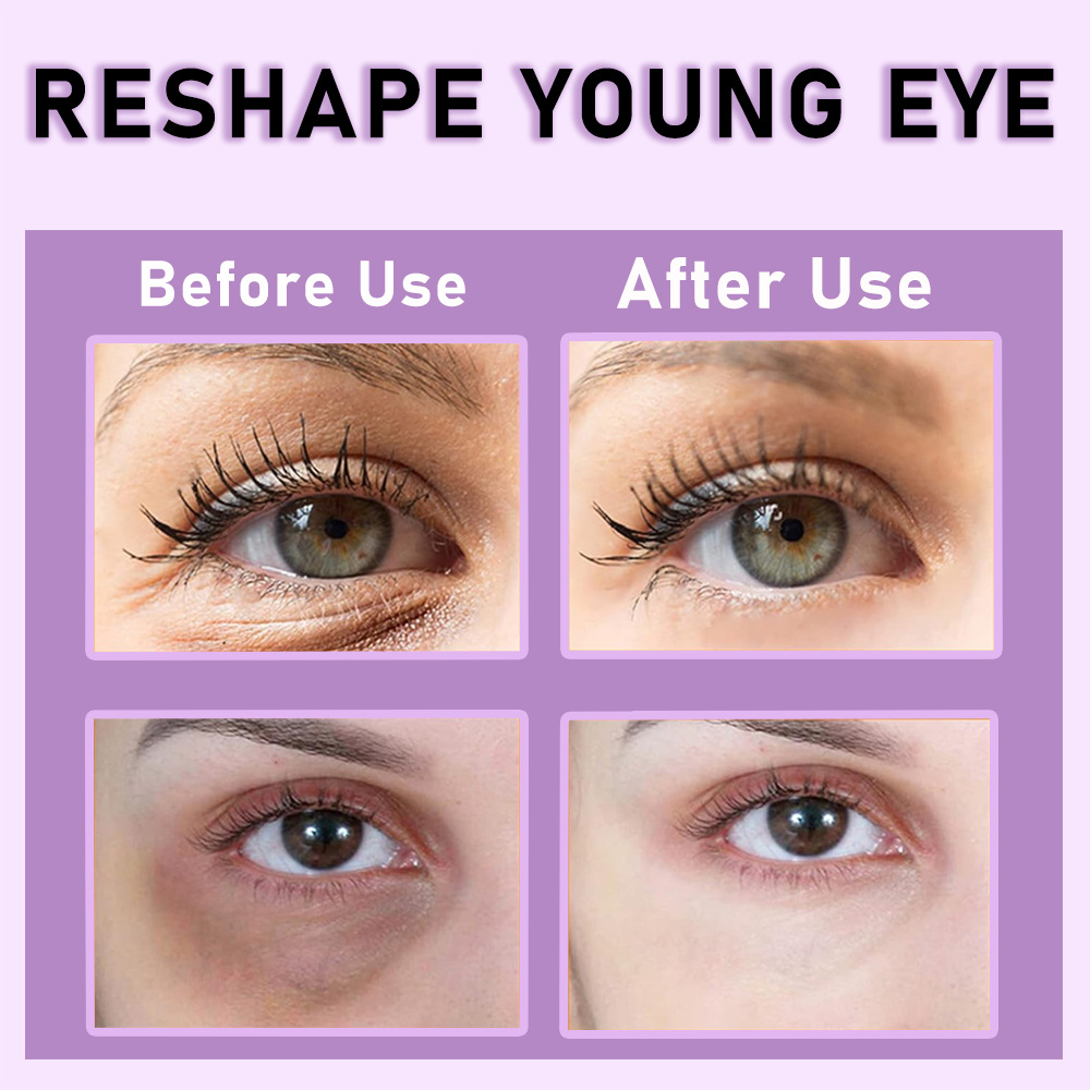 koec retinol 緊緻抗皺眼霜 20ml/盒 koec retinol 緊緻抗皺眼霜 20ml/盒